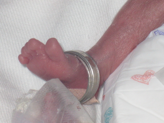 micro preemie foot